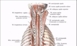 Учение о мышцах - миология Какие бывают боли